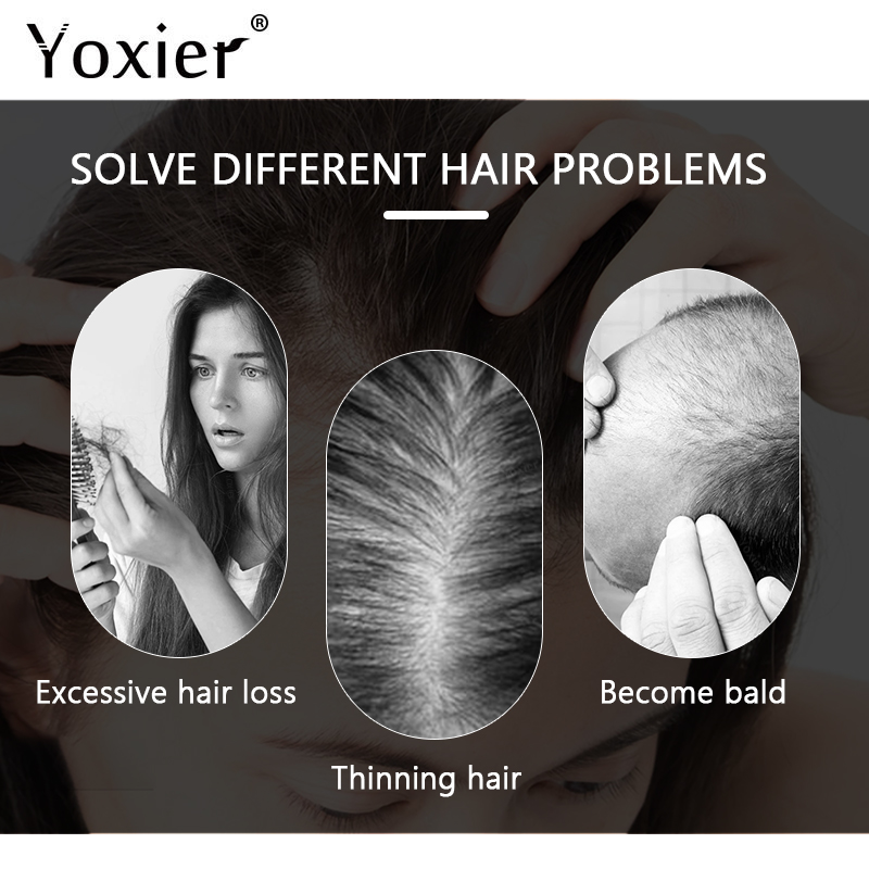 Intensive Growth Serum Prevent - Hair Care Treatment 评论和价格