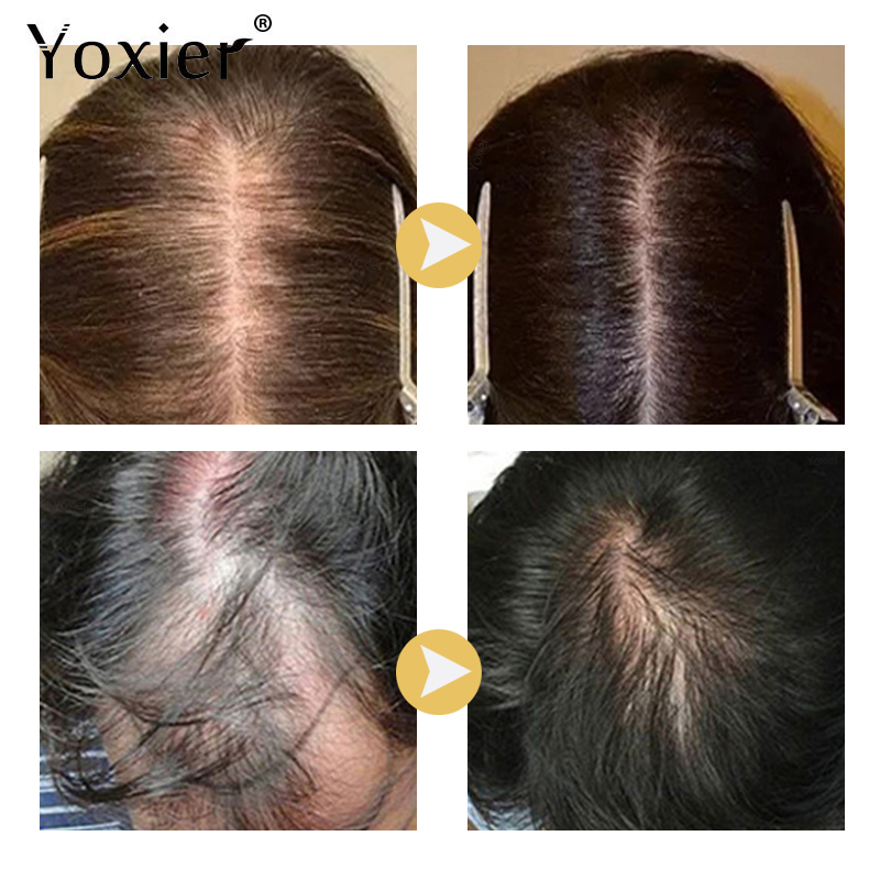 Intensive Growth Serum Prevent - Hair Care Treatment 评论和价格